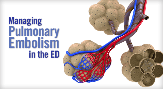 Managing Pulmonary Embolism in the ED