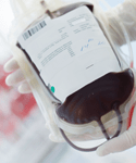 Wide Variation in Blood Transfusion Use
