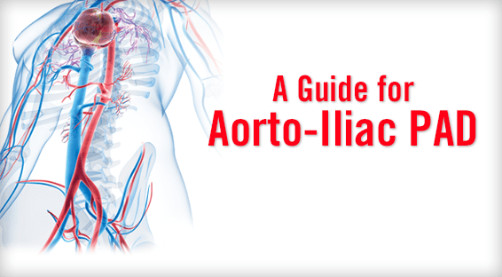 A Guide for Aorto-Iliac PAD