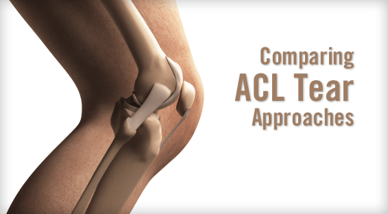 Comparing Approaches to ACL Tears