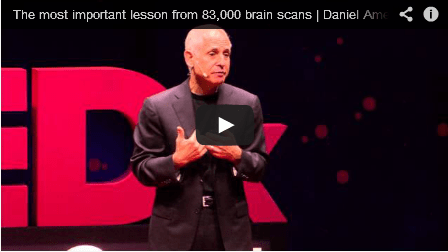 The Most Important Lesson From 83,000 Brain Scans