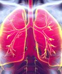 Atezolizumab A Promising Option for Early-Stage NSCLC