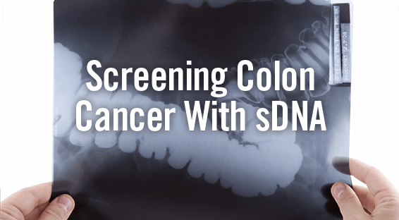 Screening Colon Cancer With sDNA