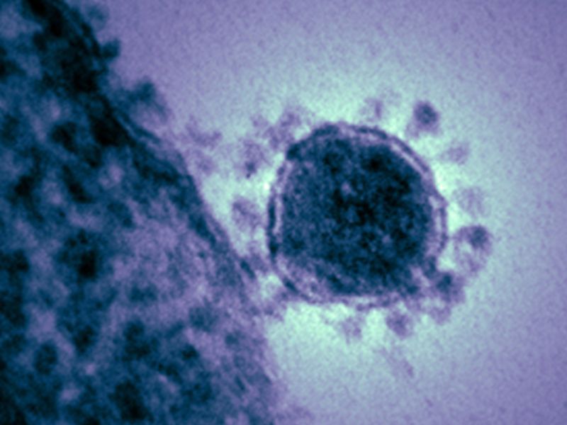 First U.S. Patient With Coronavirus ID’d in Washington State