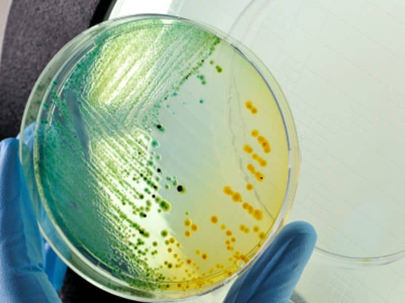 CDC: Superbug Fungus Has Sickened 600 Americans