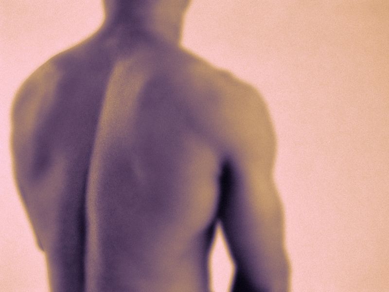 ASA: Dorsal Root Ganglion Stimulation Disrupts Back Pain