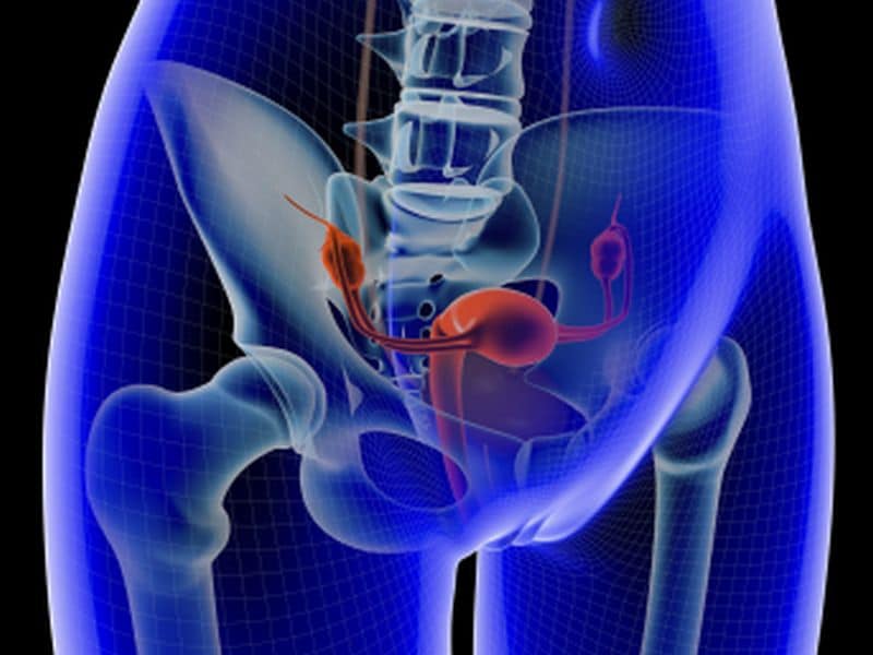 Minimally Invasive Sx May Up Mortality in Early Cervical Cancer