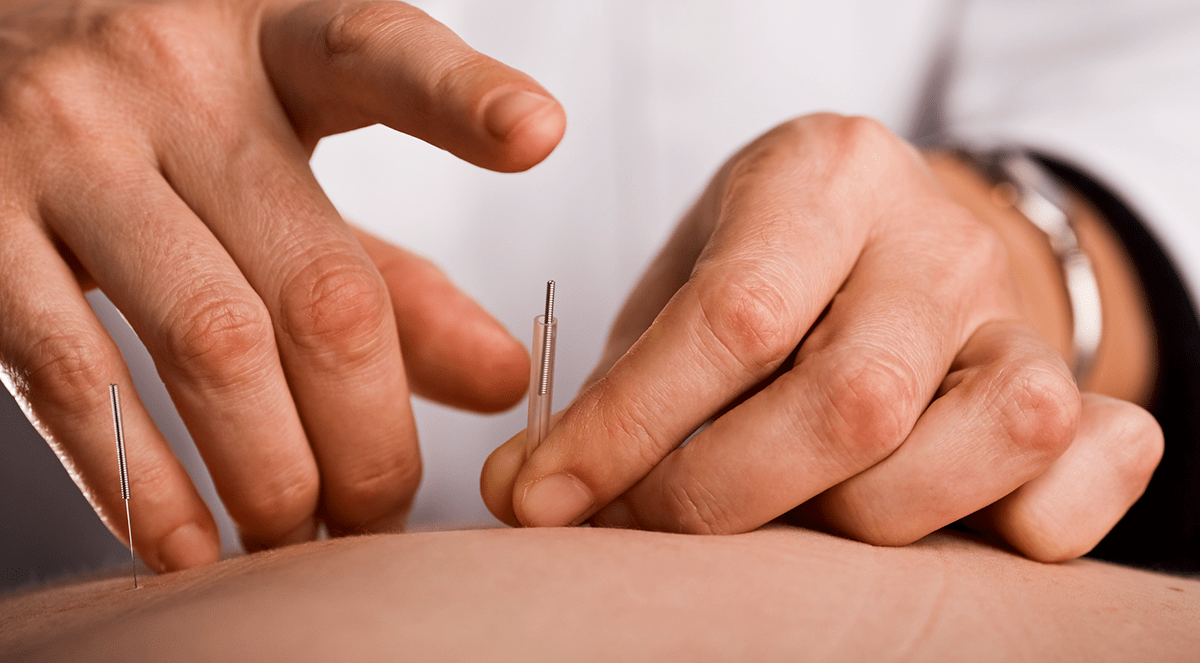 Acupuncture Boosts Effectiveness of Standard Medical Care for Chronic Pain, Depression