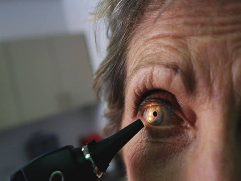 Vitamins, Carotenoids Associated With Lower Risk for Cataract