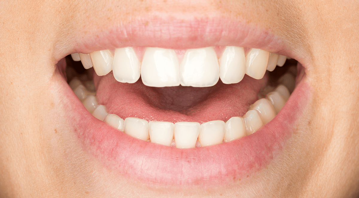 Researchers Find More Evidence of Link Between Severe Gum Disease and Cancer Risk