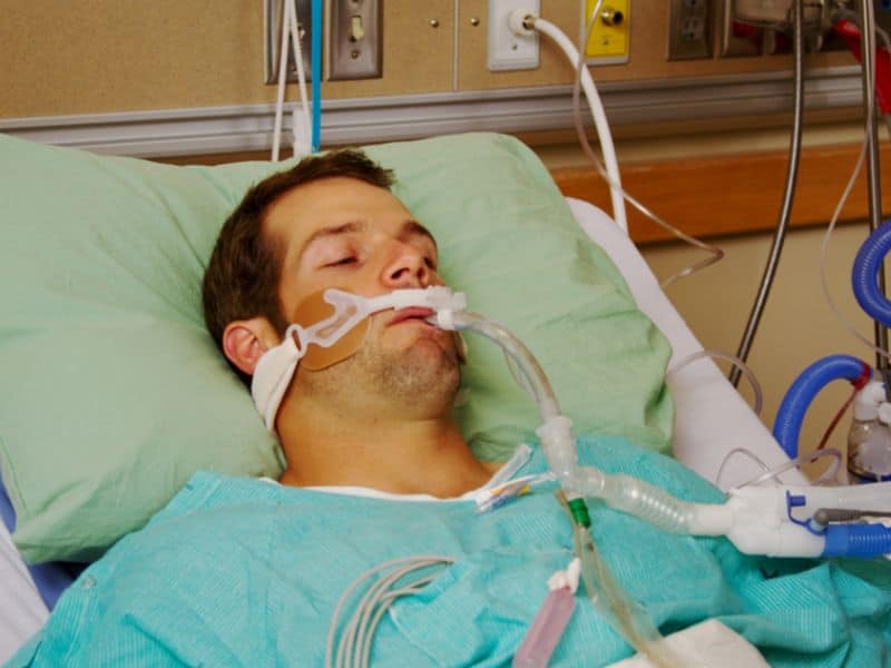 Many Nurses Believe in Sedation for Comfort of Ventilated Patients