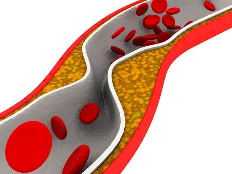 New Blood Thinner Better at Preventing Recurrent Blood Clots than Aspirin