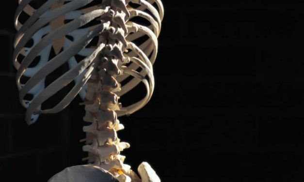Tool Uses Spine X-Rays to Assess Response to Osteoporosis Tx