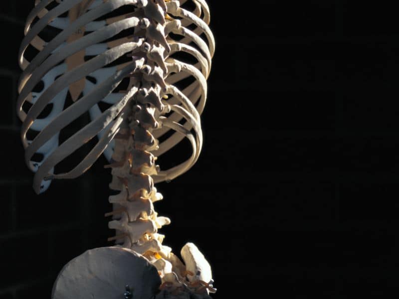 Tool Uses Spine X-Rays to Assess Response to Osteoporosis Tx