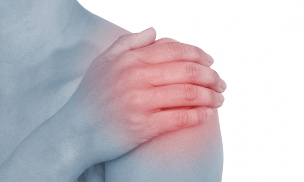 Rheumatoid Arthritis & CVD Risk