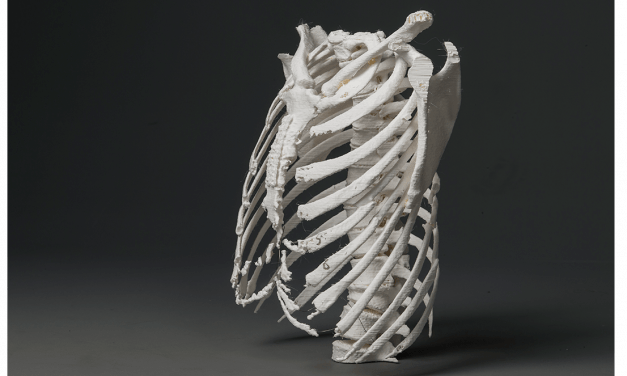 Implementing In-Hospital 3D Printing