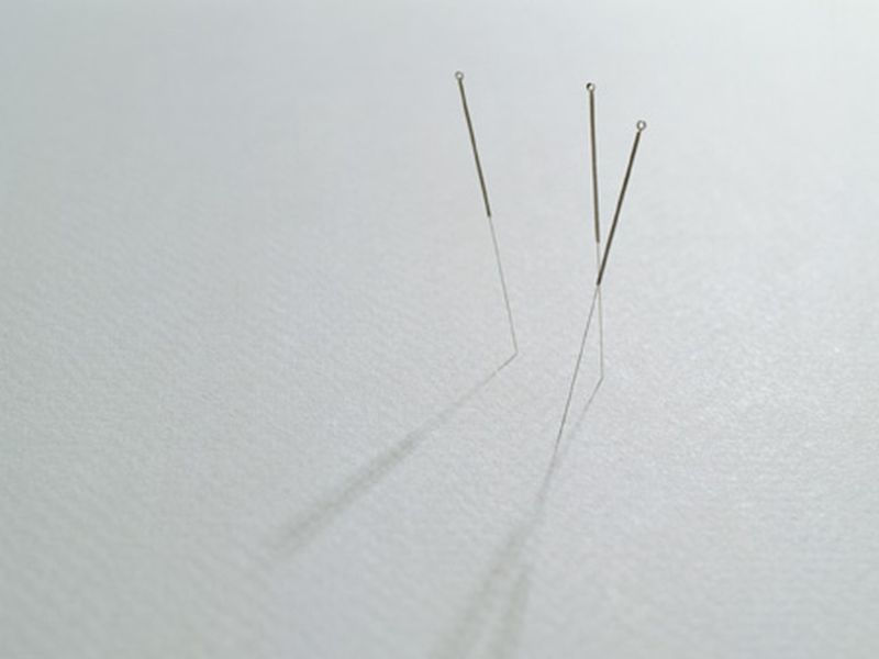 Acupuncture Alleviates Moderate-to-Severe Menopause Symptoms