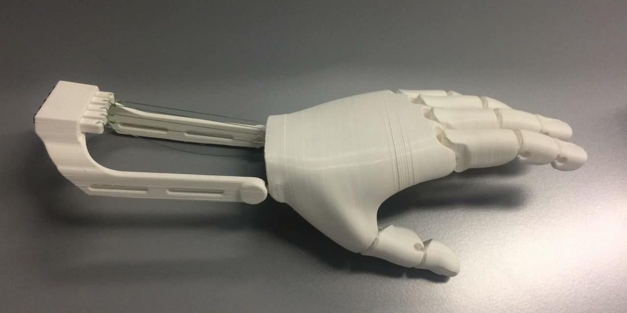 Bringing 3D-Printed Prosthetic Hands to Third-World Countries