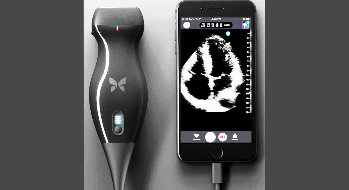 Can a handheld ultrasound replace your doctor?
