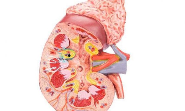 Cardiovascular Outcomes: Kidney Transplant Patients With ADPKD