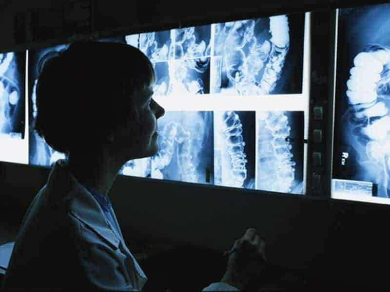 Radiologists Can Help ID Intimate Partner Violence