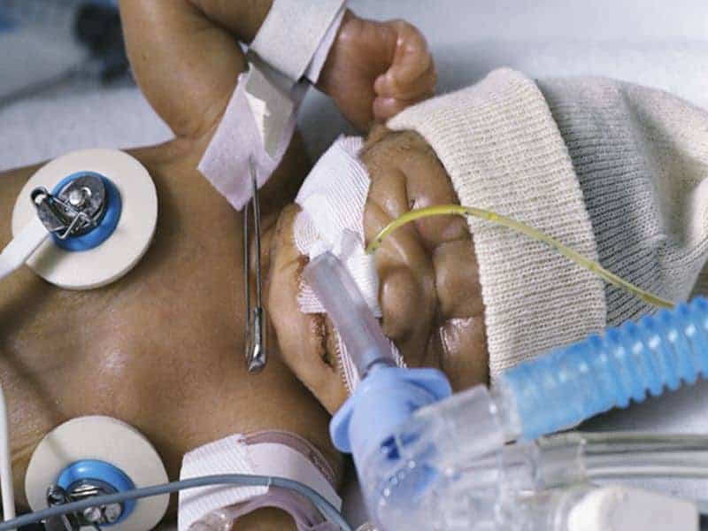 Vitamin D Supplement Tied to Less Wheezing in Black Preemies