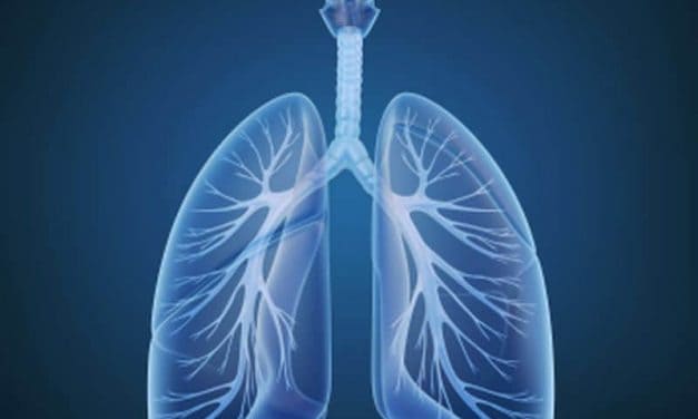 Risk Models Help Select Ever Smokers for Lung CA Screening