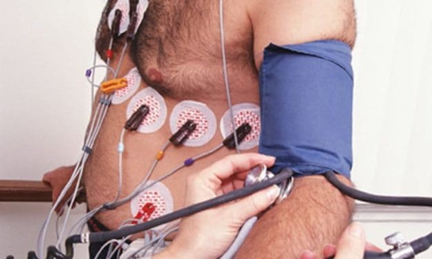 Rates of Cardiac Stress Testing Down but Still Higher in CKD
