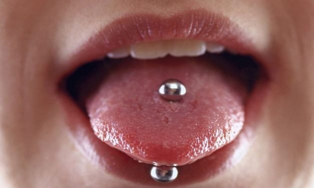 Periodontal Inflammation a Risk With Tongue Piercing