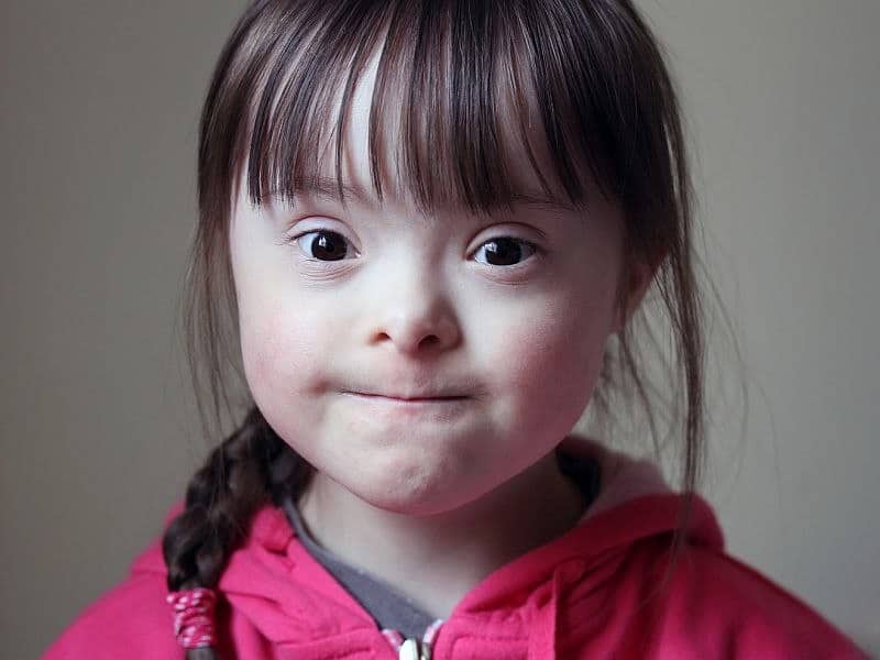 Functional Milestones Identified for Persons With Down Syndrome