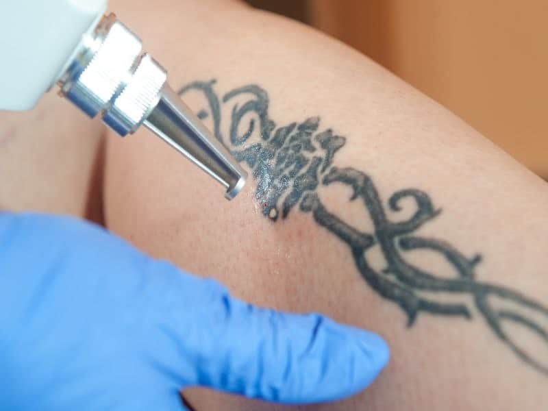 Formaldehyde Release from Tattoo Ink Sterilization
