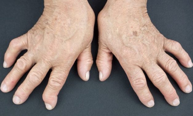 Hidradenitis Suppurativa & Inflammatory Arthritis