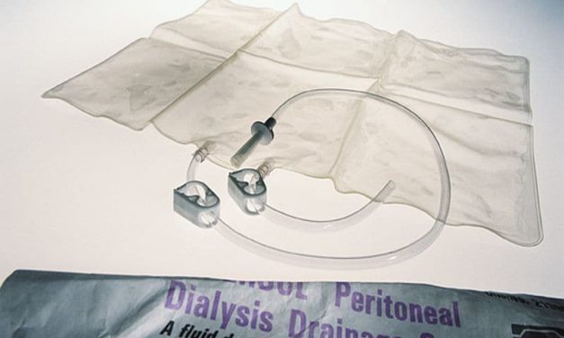 Volume Overload Present in Patients on Peritoneal Dialysis