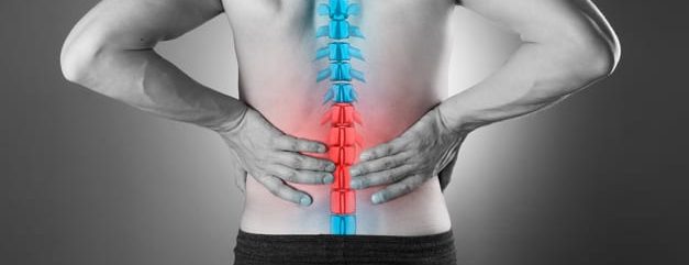 The Impact of NSAID Allergies on Opioid Use Disorder in Back Pain