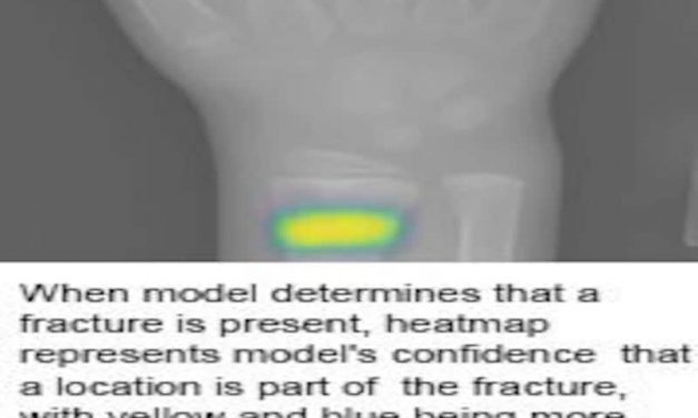 Deep Neural Network Improves Detection of Wrist Fractures