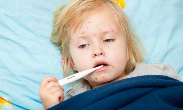 CDC: 555 Confirmed Measles Cases in U.S. Since Jan. 1
