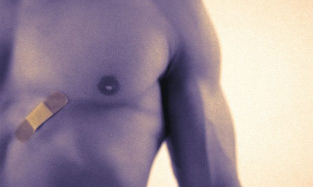 Treatment of Male Breast Cancer Has Evolved From 2004 to 2014