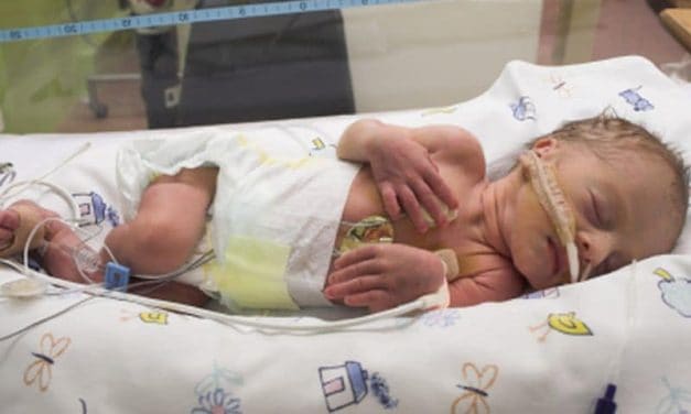 Haptoglobin Expression Tied to Outcomes in Preterm Newborns
