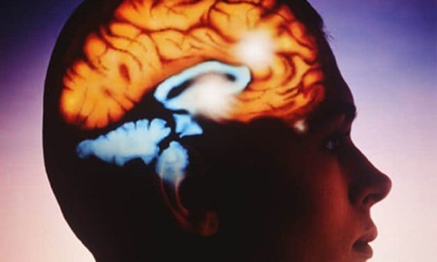 Exposure to Anticholinergics May Increase Dementia Risk