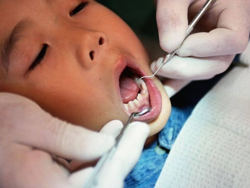 Childhood Oral Infection Linked to Atherosclerosis in Adulthood