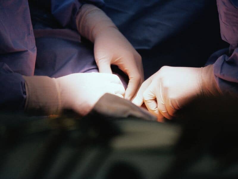 Open Heart Surgery Beats Stents for Multivessel Disease