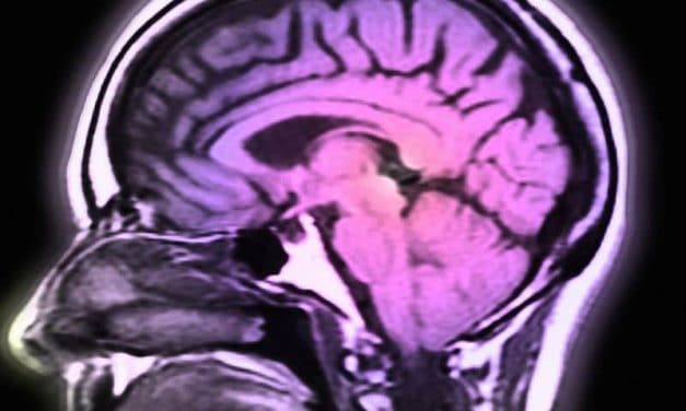 Early Adult Income Volatility Tied to Later Brain Health