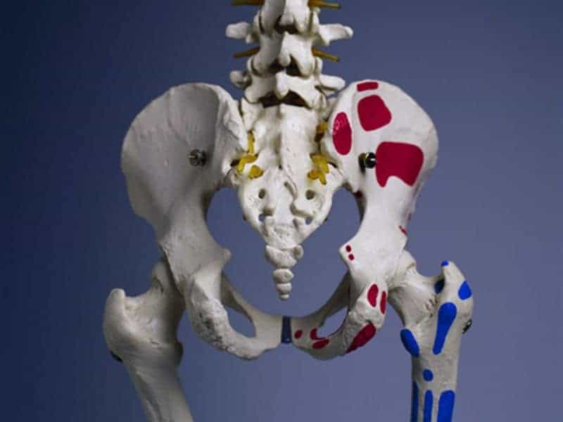 Hip Fracture Linked to Increased Risk for Death in T2DM Patients