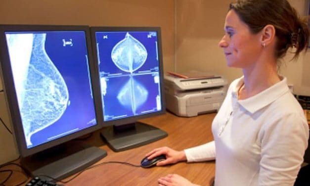 Breast Cancer & A-Fib