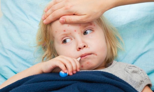 CDC: U.S. Measles Cases in 2019 Reach 839