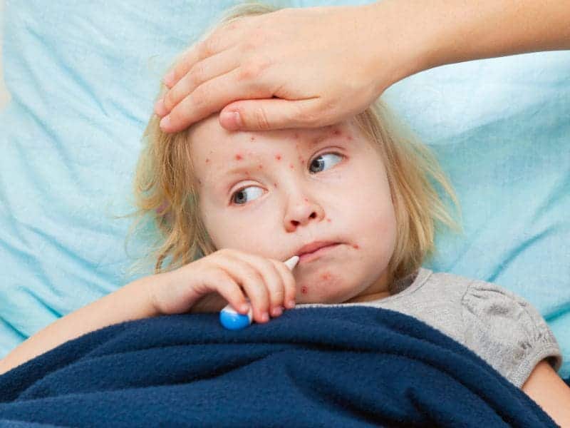 Fewer New Measles Cases Reported Last Week in U.S.