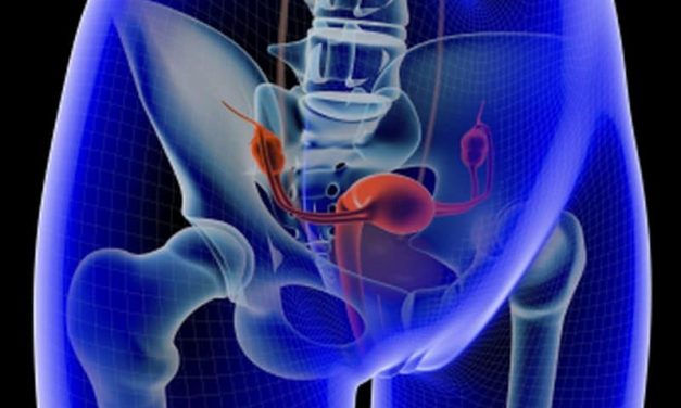 PARP Inhibitor Slows Progression of Advanced Ovarian Cancer