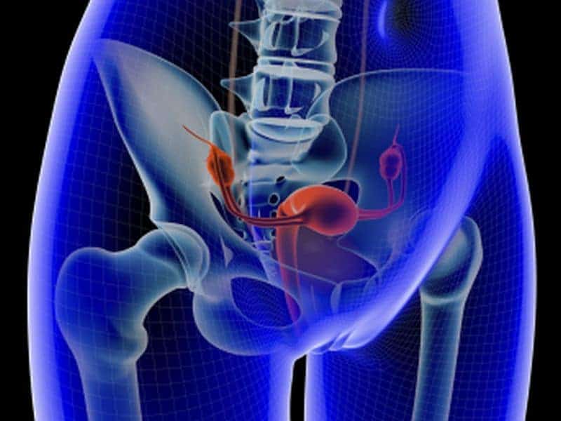 Incidence Rates for Aggressive Uterine Cancers on the Rise