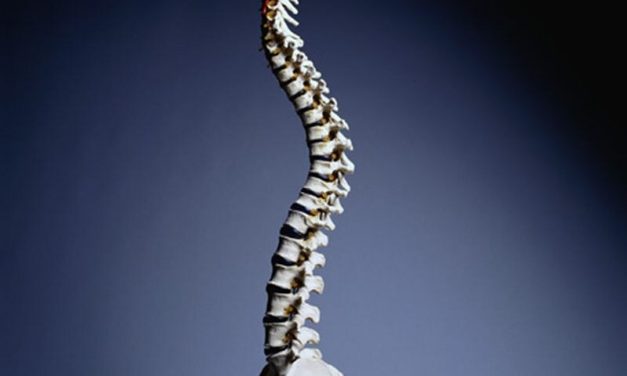 Microbes Tied to Pedicle Screw Loosening, Spinal Implant Failure