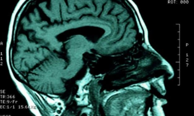 Infections Tied to Subsequent Risk for Acute Ischemic Stroke